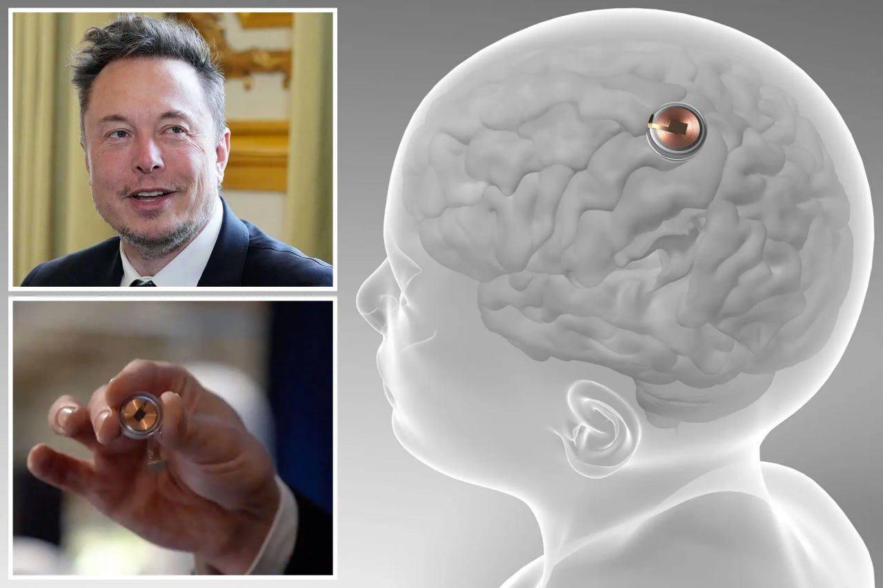 Компания Илона Маска впервые в истории человечества вживила чип в мозг человека